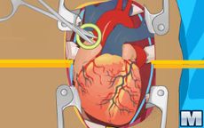 Heart Surgery