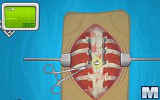 Operate Now: Scoliosis Surgery 