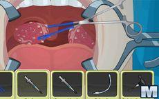 Operate now: Tonsil Surgery